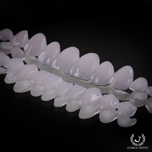 Lentes de contato nos dentes