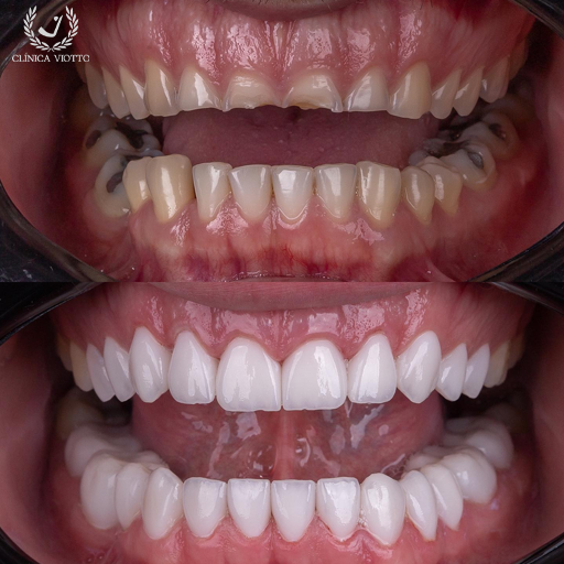Reabilitação Oral Viotto Sorriso Reabilitação Oral Viotto Sorriso