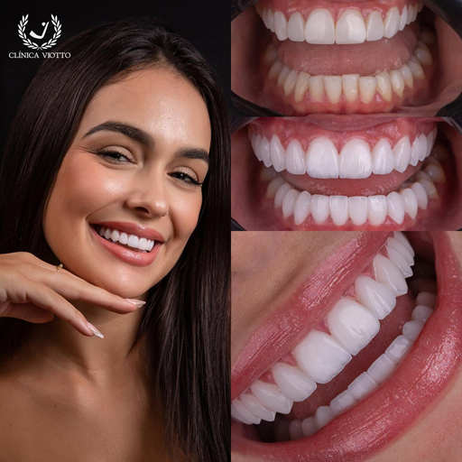 Transformação estética para sorriso perfeito